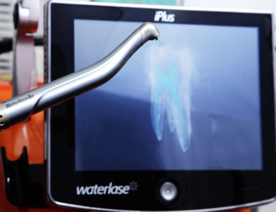 Laser et soins dentaires Laser et soins dentaires